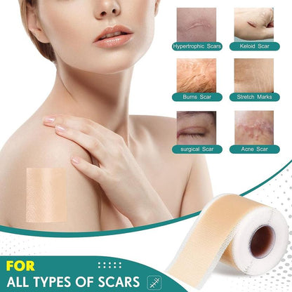 Silicone Scar Sheets