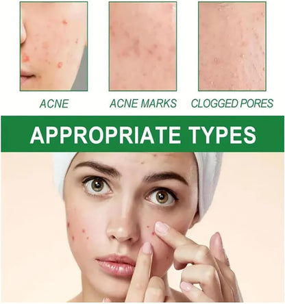 Modern Chinese Acne Treatment