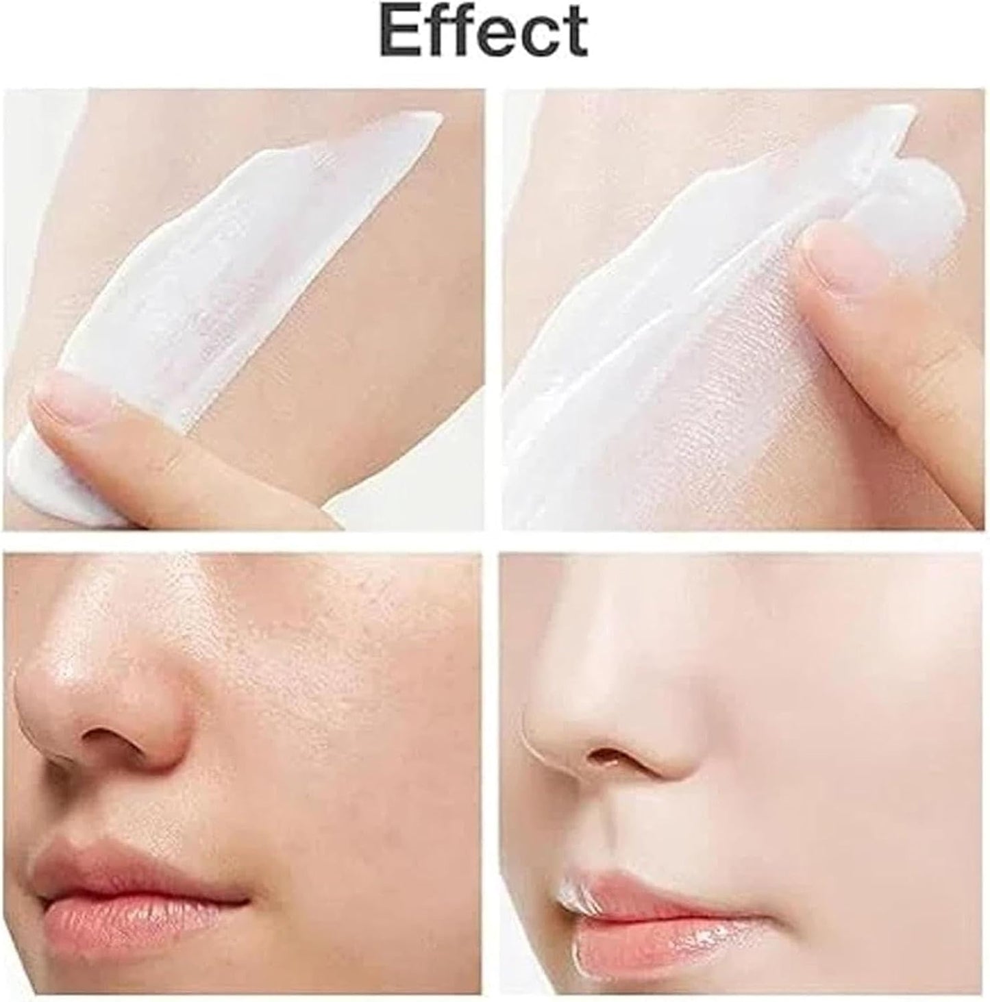 Modern Chinese Acne Treatment