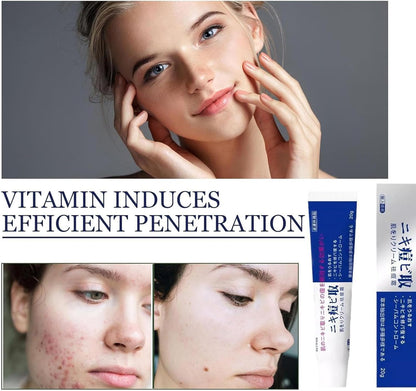 Modern Chinese Acne Treatment
