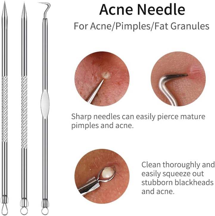 Blackhead Remover Set