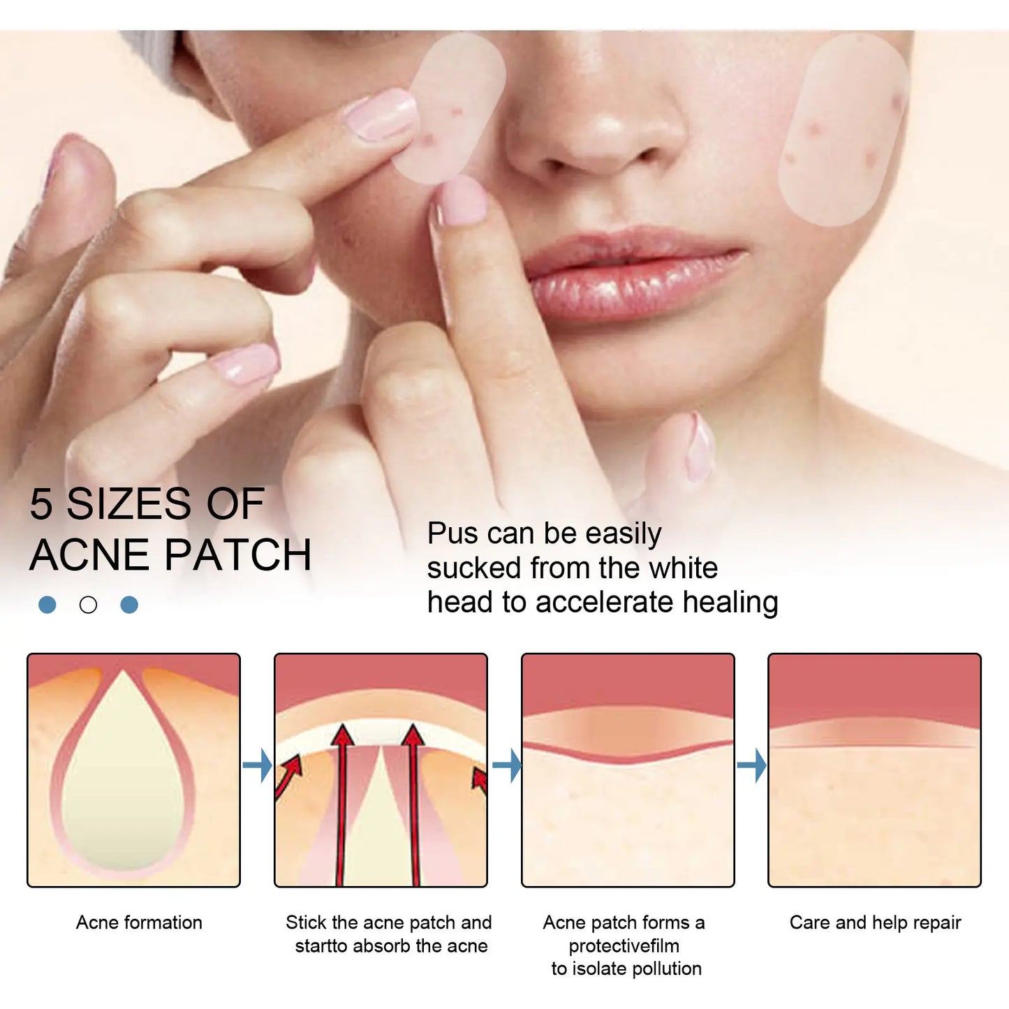 Large Pimple Patches