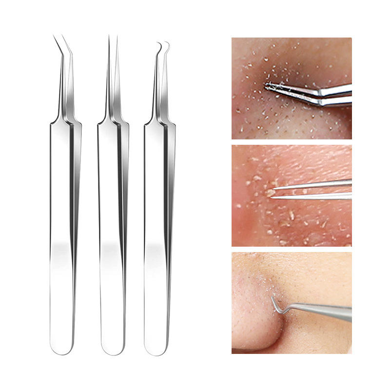Blackhead Remover Set