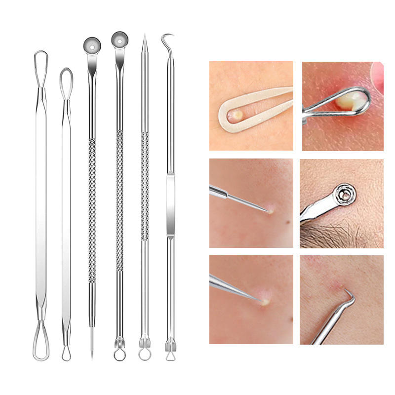 Blackhead Remover Set