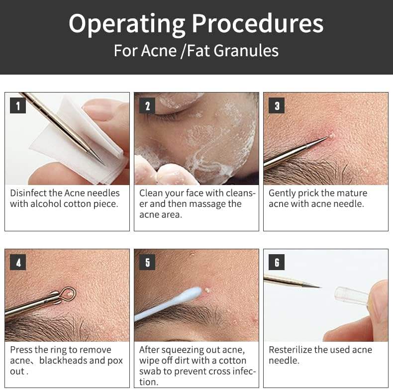 Blackhead Remover Set