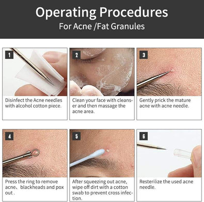 Blackhead Remover Set