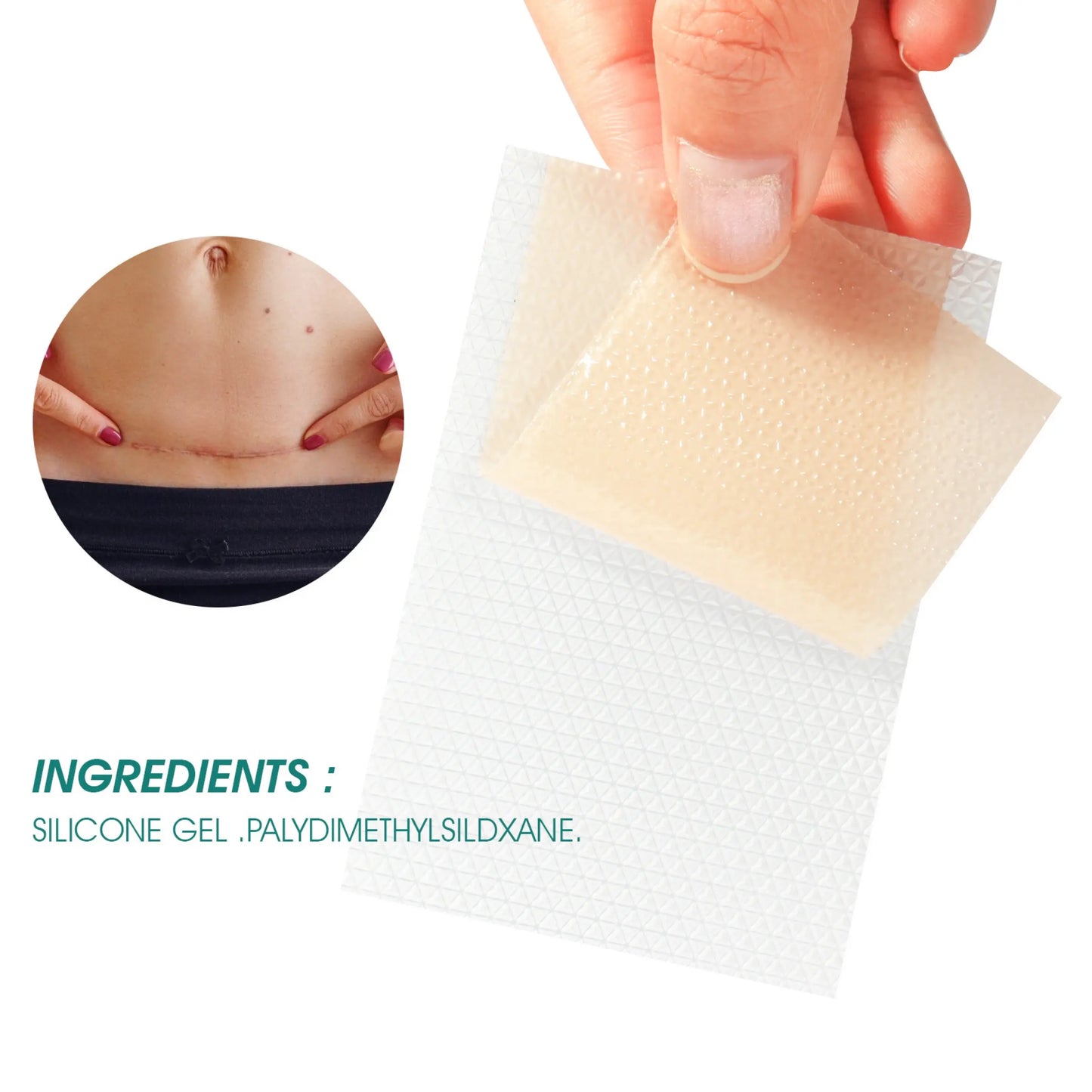 Silicone Scar Sheets