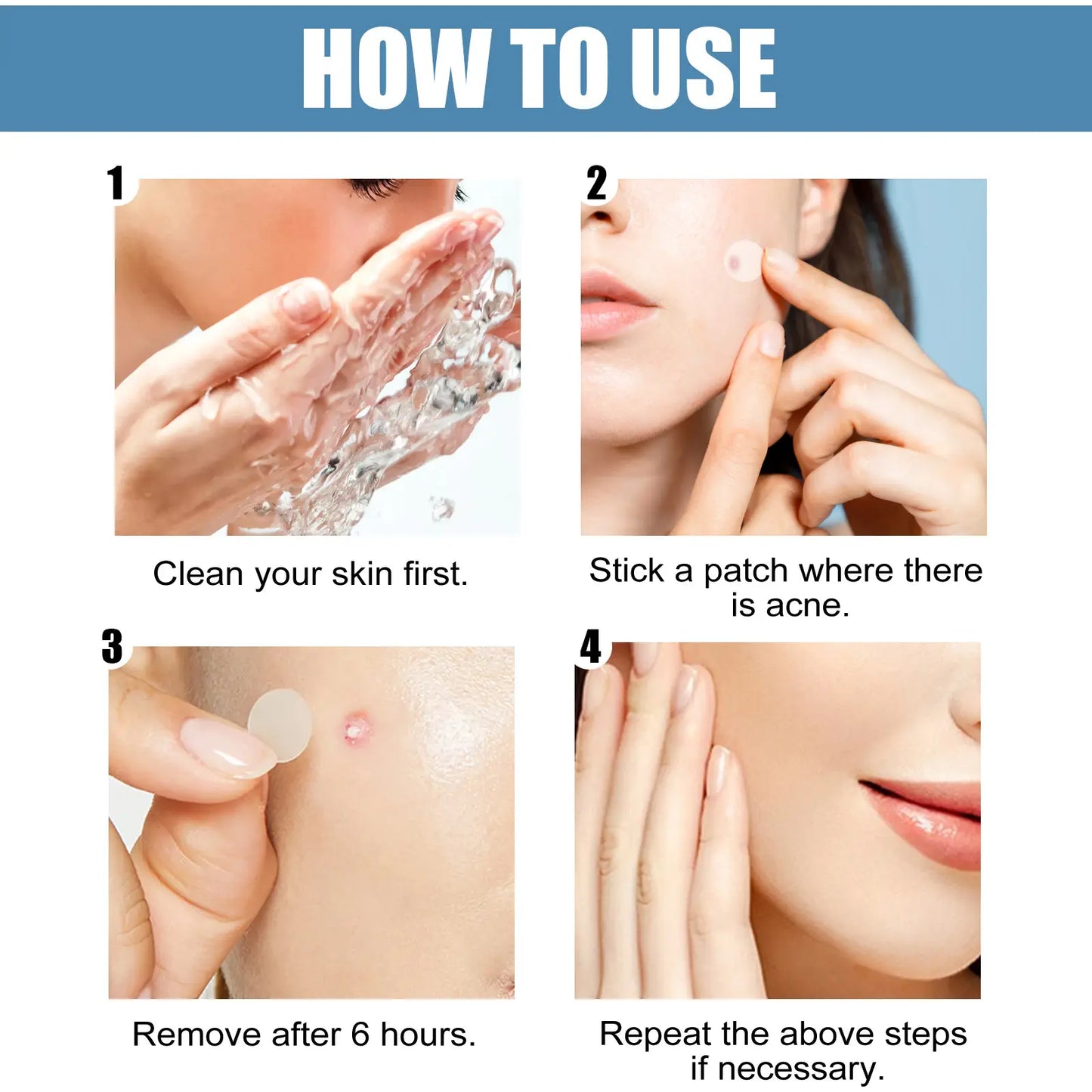 Large Pimple Patches