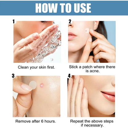 Large Pimple Patches