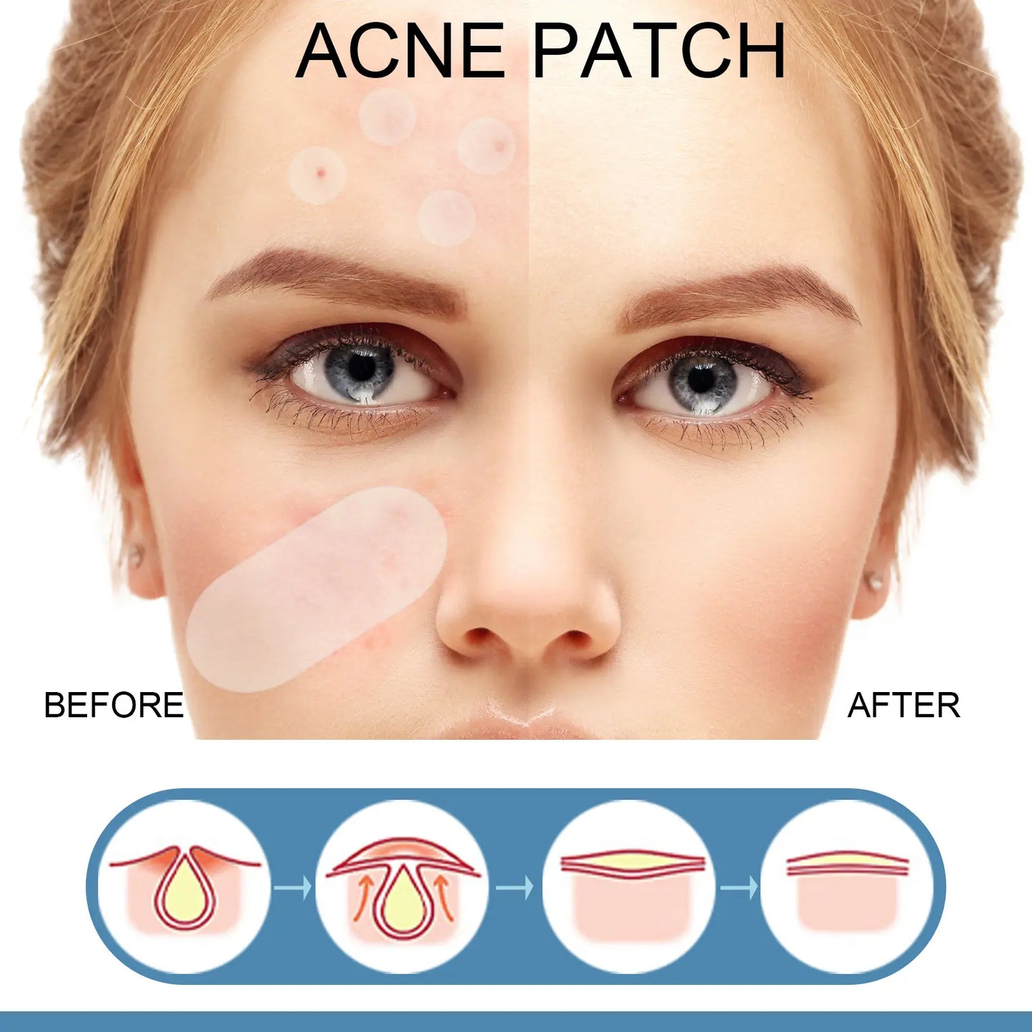 Large Pimple Patches