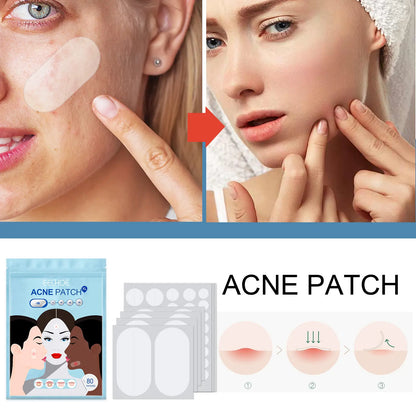 Large Pimple Patches