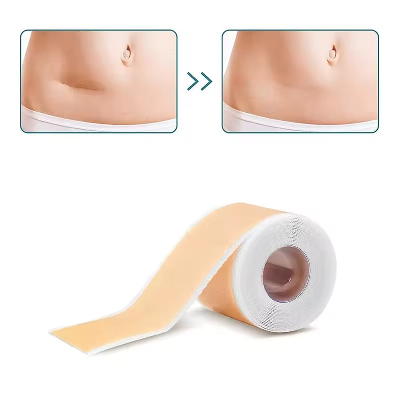 Silicone Scar Sheets